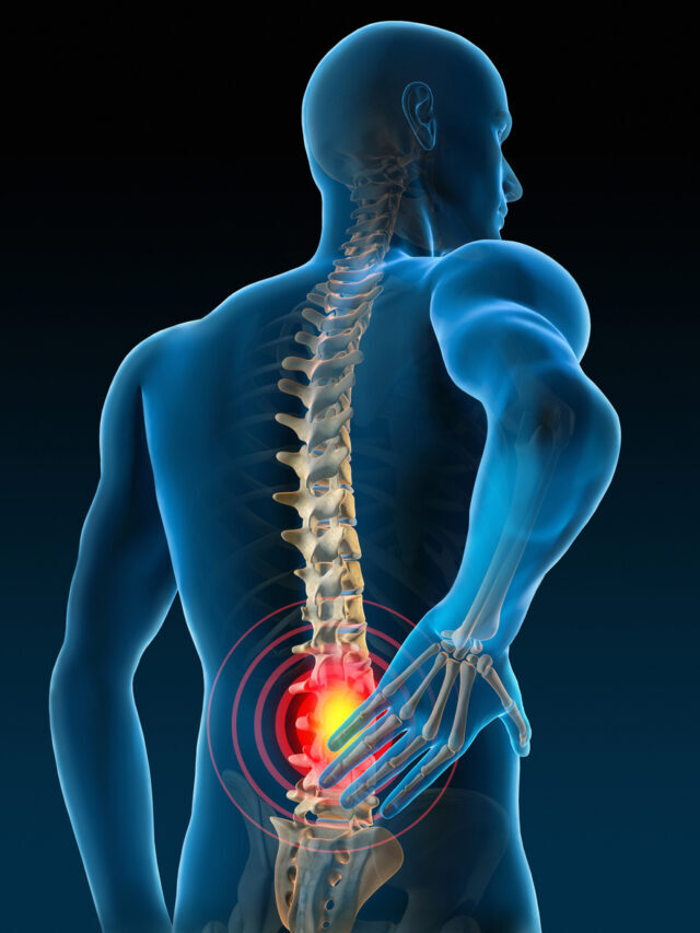 How to relieve lower back pain fast